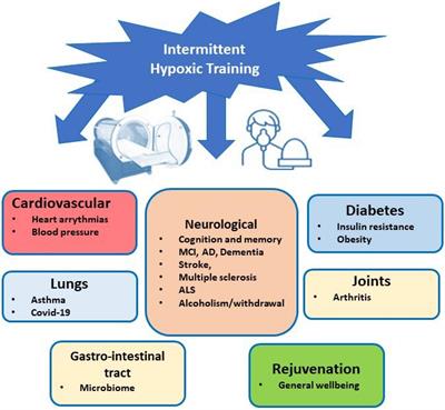 Intermittent Hypoxic Training as an Effective Tool for Increasing the Adaptive Potential, Endurance and Working Capacity of the Brain